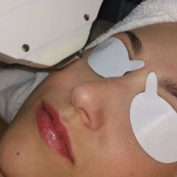 IPL & Laser Consumables