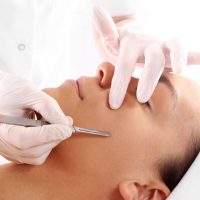 Micro Dermaplaning